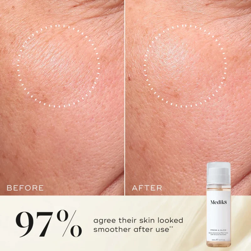 Press & Glow (Daily Exfoliating PHA Tonic with Enzyme Activator) - Image 4